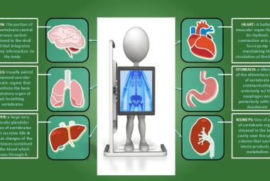 Karoona CIOS in Robotic Surgery